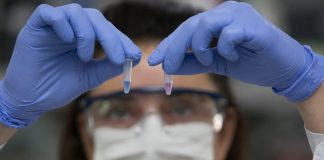 Nuevo test de diagnóstico rápido: “Se aplica solo para confirmar si un caso sospechoso es o no positivo”