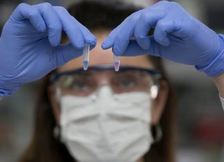 Nuevo test de diagnóstico rápido: “Se aplica solo para confirmar si un caso sospechoso es o no positivo”